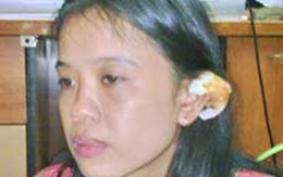 Chồng thiếu nợ, vợ bị cắt tai