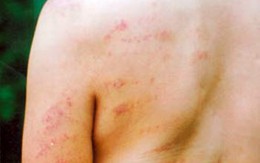 "Giám đốc tra tấn học viên khuyết tật" ở Hà Tĩnh: Nạn nhân hoảng loạn, Phòng - Sở "bình chân"