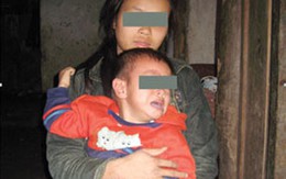 Vụ xâm hại thiếu nữ tật nguyền, sinh con: Nỗi đau nhân đôi