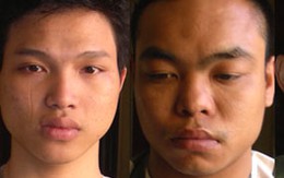 TP.HCM: Bảo vệ quán bar đánh chết người
