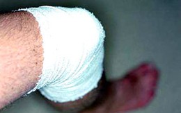 "Dính" đạn vì đứng xem đánh nhau 