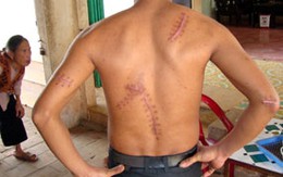Vụ chém người tại Minh Phú: Chưa đòi được công bằng do sức khỏe yếu?