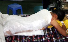 Chồng dội nồi canh đang sôi lên người vợ