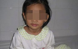 Mắc bệnh "ăn tóc" do cha mẹ không quan tâm