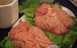 Ăn óc coi chừng tai biến mạch máu não   