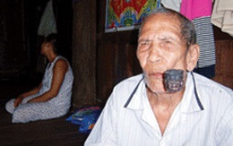 'Vua voi' Ama Kông không bị vợ chém đứt tay 