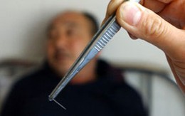 Kim nằm trong mông 31 năm