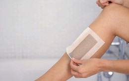 Phụ nữ rậm lông đa phần do bệnh lý