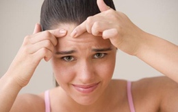 6 quy tắc vàng ngăn ngừa mụn