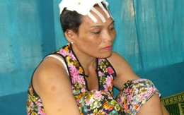 Nỗi đau của người vợ bị chồng cắt da đầu