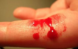 Tự chặt ngón tay vì bị trả lương chậm