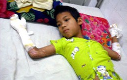 Cháu bé 11 tuổi bị tra tấn, thiêu sống dã man