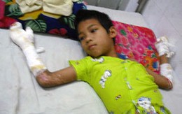 Khởi tố vụ án cháu bé 11 tuổi bị anh họ thiêu sống