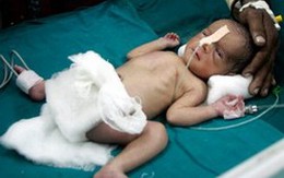 Những ca sinh nở "ly kì" nhất thế giới
