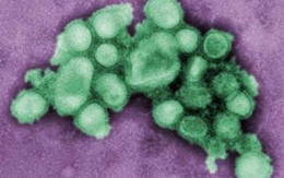 Nguồn gốc bí ẩn của virus H1N1 