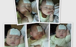 Có nên dùng miếng dán hạ sốt cho trẻ?