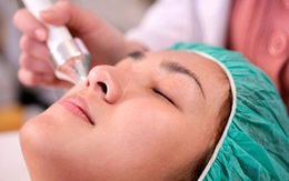 Bỏng, sẹo chỉ vì muốn đẹp hơn