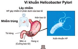 Thầy thuốc nuốt vi trùng