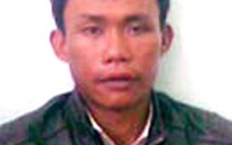 Đi thẩm mỹ để trốn tội 