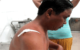 Côn đồ chém trung tá cảnh sát