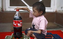 Ai là người đàn ông nhỏ nhất thế giới?