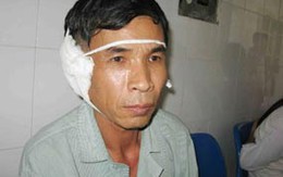 Điếc, thậm chí tử vong vì chữa viêm tai bằng sáp ong