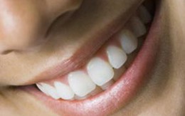 10 chú ý khi đi nhổ răng