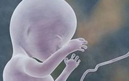 Bé gái duy nhất trên thế giới chỉ nhìn bằng một mắt