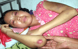 Nhậu say, đánh trọng thương vợ