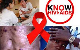 Gần 1.600 tỷ đồng đầu tư phòng, chống HIV/AIDS