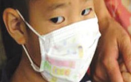 Dịch hạch có thể truyền bệnh do thú nuôi trong nhà