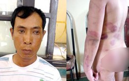 Đánh dã man con đẻ bằng thắt lưng quần