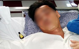 Phạm nhân nhét hai chiếc điện thoại vào hậu môn