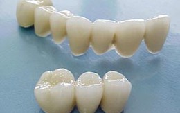 Chữa một chiếc răng, bị nhổ cả hàm