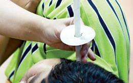 Lấy ráy tai bằng lửa: Dễ bỏng như chơi