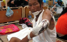 Vô cớ chém trọng thương 4 người