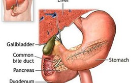 Xét nghiệm máu phát hiện sớm ung thư dạ dày và ruột