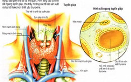 Phẫu thuật tuyến giáp không để lại sẹo