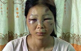 Quả phụ bị đâm 5 nhát vẫn bắt được nữ cướp