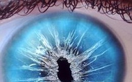 Dấu hiệu báo động mắt bạn gặp nguy hiểm