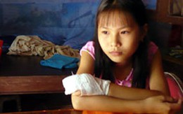 Vụ bé gái bị cậu chặt cụt tay: Lấy tiền để giúp bạn
