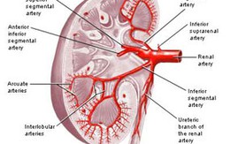 Votrient - Biện pháp mới điều trị ung thư thận 