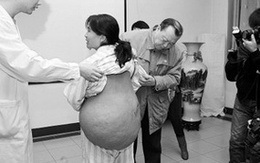 Người phụ nữ mắc bệnh "mai rùa"
