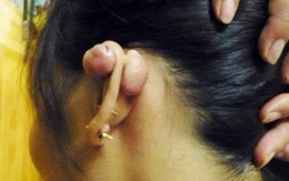 Tác hại khôn lường khi xỏ khuyên tai