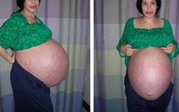 8 người mẹ khác thường nhất thế giới