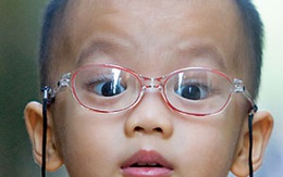 Cảnh giác với bệnh về mắt ở trẻ nhỏ