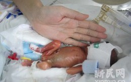 Bé sơ sinh nhỏ bằng bàn tay người lớn