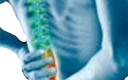 Đừng để cột sống mọc… "gai"