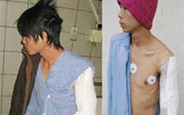 Chú rể bị côn đồ làng chém trọng thương