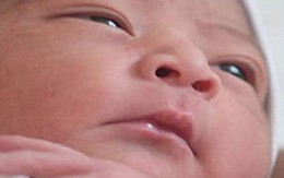 Bé gái 7 tháng tuổi sống sót sau 3 ngày bị bắn vào ngực
